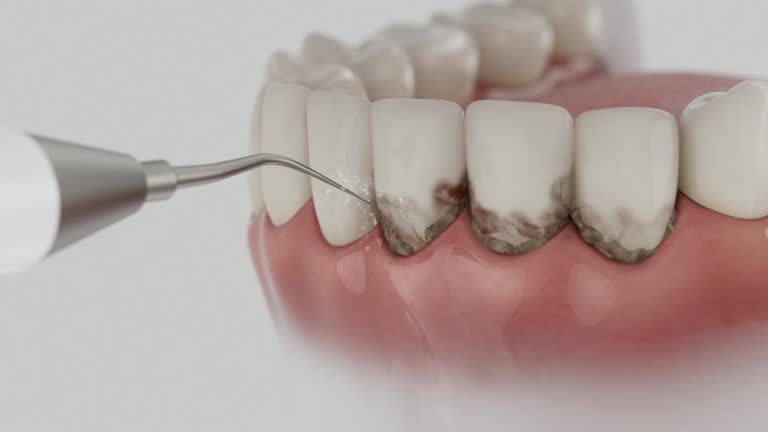 Trusted Emergency Dentist service in Moscow, ID - Dentist Open Now